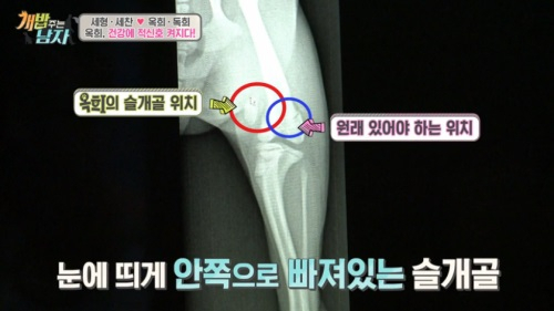 '개밥 주는 남자', 양세형 반려견 옥희…이대로 가면 십자인대 손상