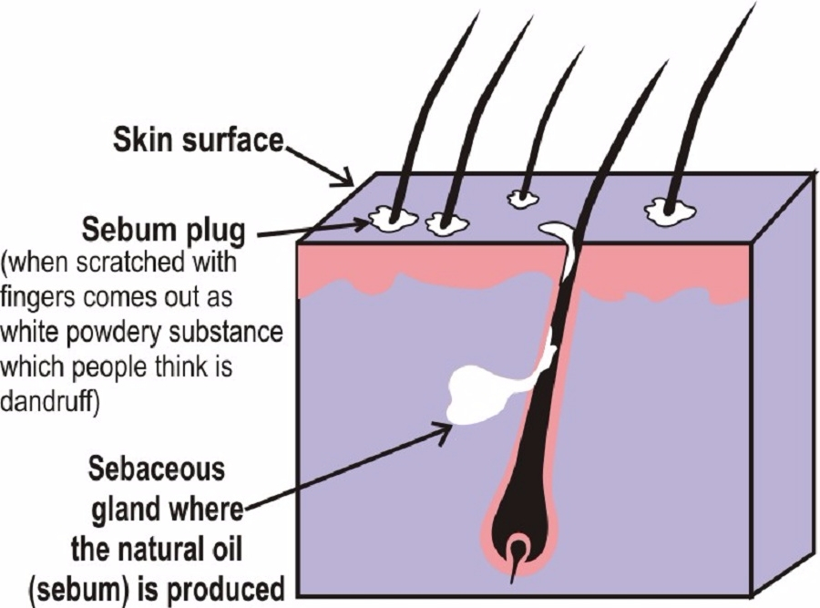 고양이 피부병, 어떤 것이 있나