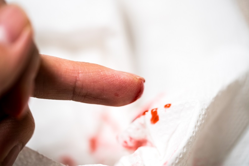 상처, 제대로 관리해야 황색포도상구균 감염 예방