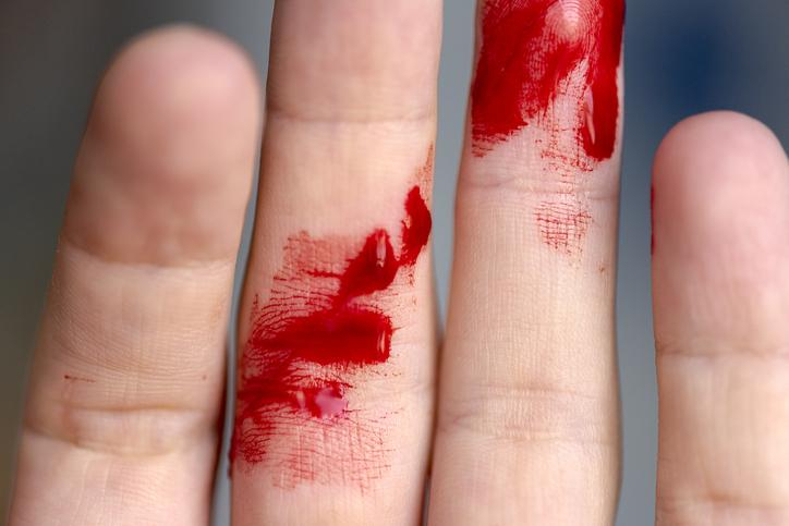 결핵 사망률 높다…'이것' 하나면 결핵과 당뇨 막을 수 있다고?