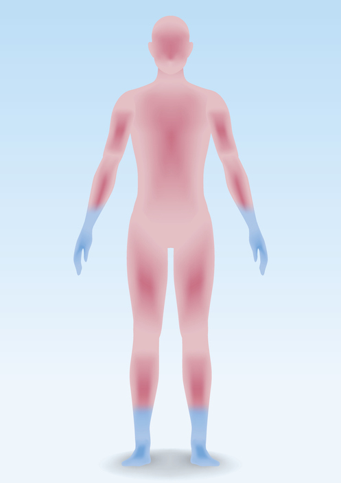 추운 겨울 발생하는 '동상', 발가락 동상 초기증상과 치료 방법은?