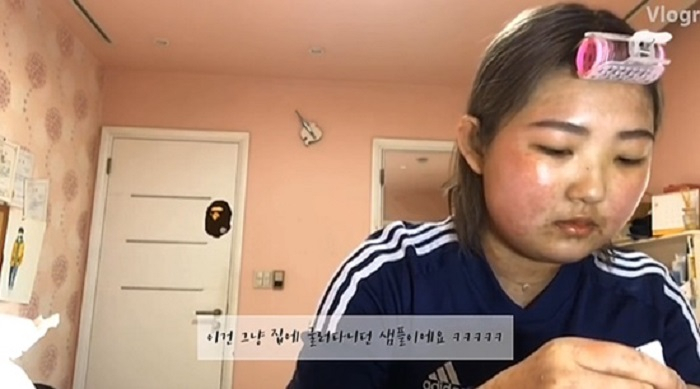 안면비대칭 교정 끝판왕은?, 故최진실 딸 최준희가 고백한 '루프스병·안면비대칭' 원인·증상까지
