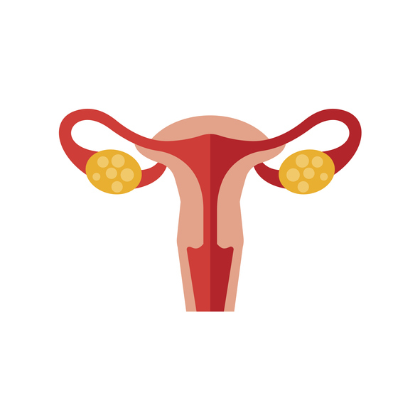 생리불순·자궁내막암 등 다양한 증상을 유발하는 다낭성 난소 증후군 치료 방법, 적절한 검사 선행돼야