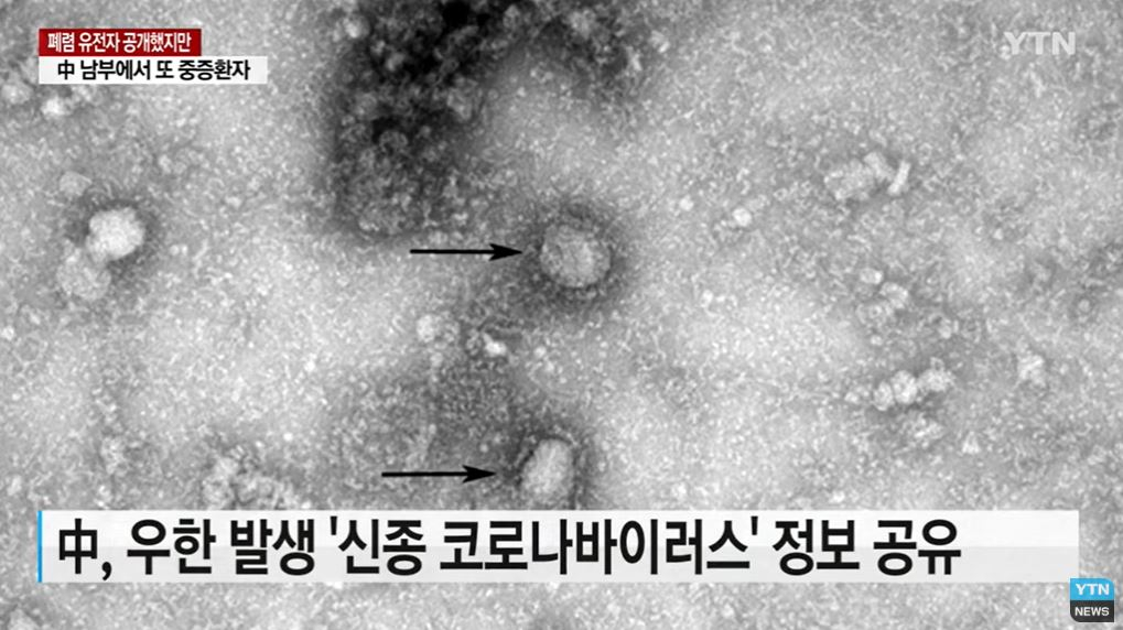 신종 코로나 바이러스 태국에서도 발견 확산 ‘비상’ 중국 폐렴 초기증상은?