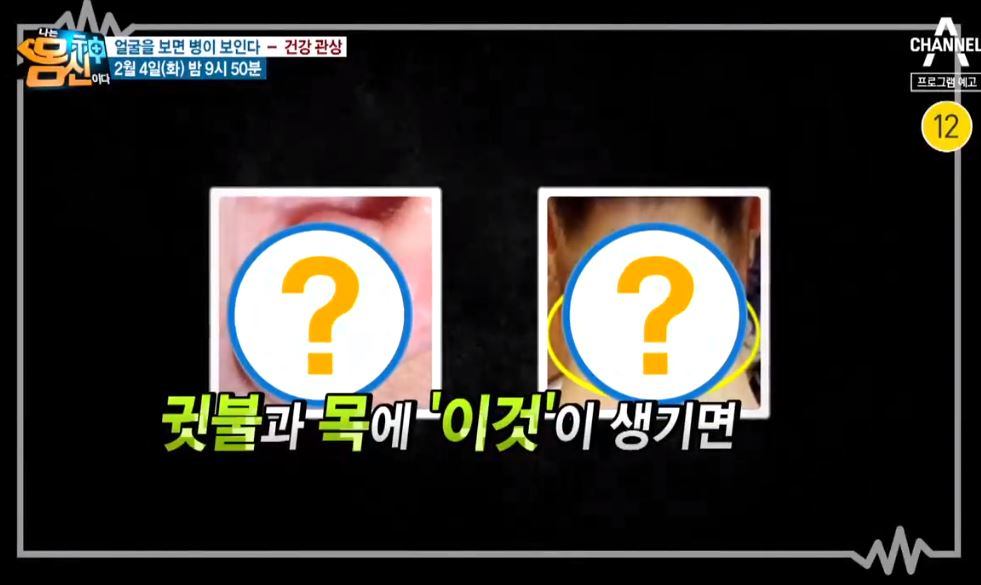 ‘나는 몸신이다’ 치매초기증상 자가진단법 ‘귓불’을 살펴 예방?