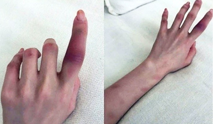 정다은-한서희 결별? 이유에 폭력 컸나 나 죽일려고 해