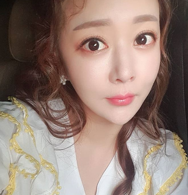 가수 금잔디, 전신성형으로 확 달라진 외모, 사연에 `뭉클`