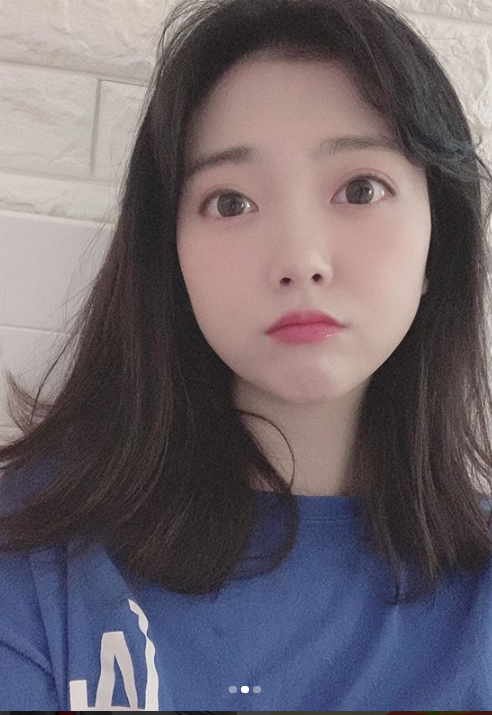 가수 요요미, 상큼한 비주얼로 근황 공개