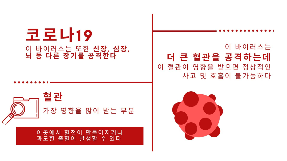 코로나19 감염된 젊은 환자 ‘뇌졸중’ 발생 사례 보고