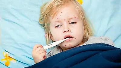 아기 수족구병 유행, 구내염 증상과 비슷하지만 전염성 있어…수족구병 초기증상 및 치료방법을 알아보자