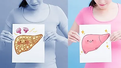 간암의 원인 및 증상, 치료방법에 대해 알아보자