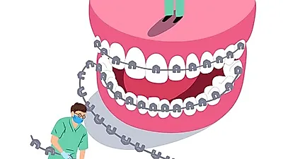 [보험가입팀] 가격부담으로 치과가기 망설여진다면 치아보험 추천…"감액기간·면책기간이란"