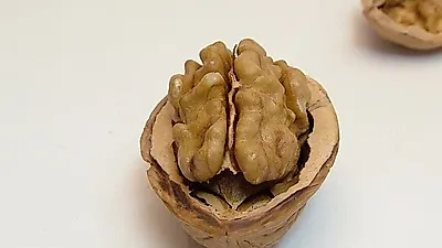 치료제 없는 치매 ,  치매의 원인과 증상 및  뇌에 좋은 음식까지
