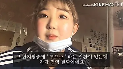 셀레나고메즈·최준희 병 '루프스병' 이란? 원인은? 루푸스 증상 10 +안면비대칭 교정방법 2