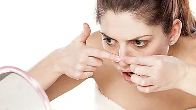 넓어지는 모공의 주범! '블랙헤드' 제거할 수 있을까?…꼼꼼한 세안이 가장 중요