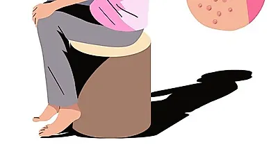 [질병관리]   "상상 이상의 고통준다!" 대상포진, 방치하면 사망까지 초래해