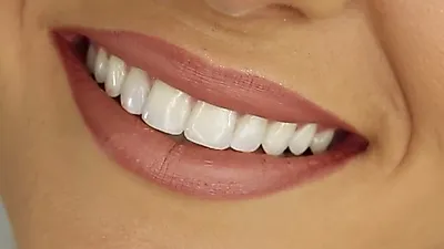 치아를 재생시키는 약 발견