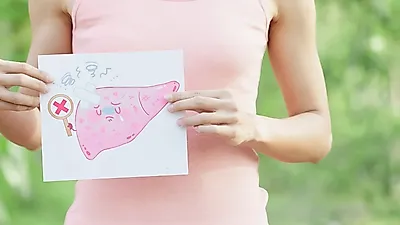 간경화 초기증상 파악·간경화에좋은음식으로 조기예방