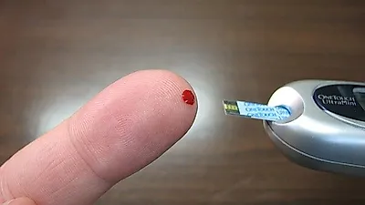 건강 위협하는 성인병 '당뇨'…"심혈관계 질환·감염성 질병·신경병증 등 합병증 발전 위험"
