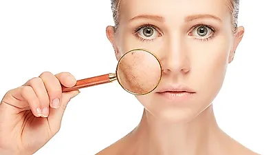 한번 생기면 제거하기 힘든 '기미주근깨' 없애는 법은?