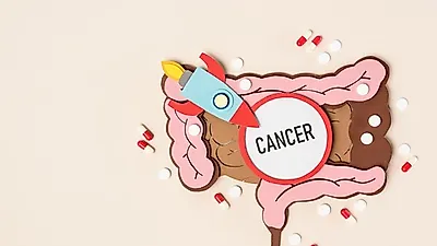 발병률 세계 1위! 대한민국   '대장암'…"변 모양 확인해야"