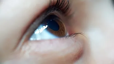 눈에 이물감 느껴지는 눈 다래끼 원인, 전염될까? 약·찜질 등 눈 다래끼 치료로 빨리 낫는 법