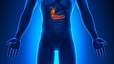 명치통증, 황달, 체증감소…췌장암 증상? 췌장암 초기증상 미미해 발견 어려울 수 있어