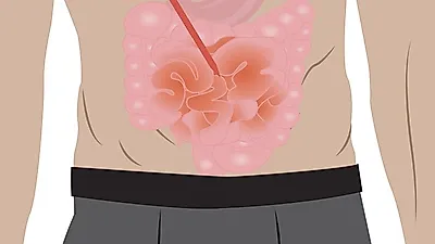 면역력 너무 낮으면 프로바이오틱스 섭취에 주의해야? 프로바이오틱스의 효능 및 먹는 방법까지