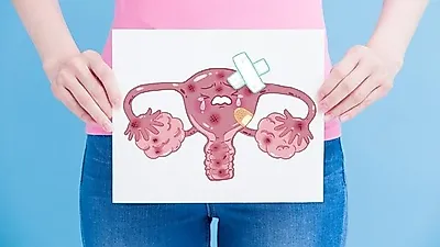 자궁경부암의 전단계인 자궁경부 이형성증의 원인과 증상, 치료 방법