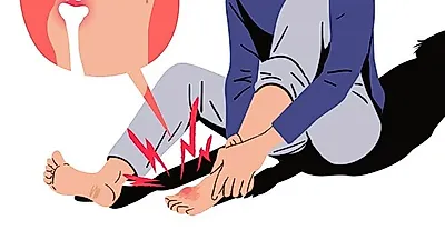 식습관이 불러오는 극심한 통증, '귀족병' 통풍의 초기증상과 주요원인
