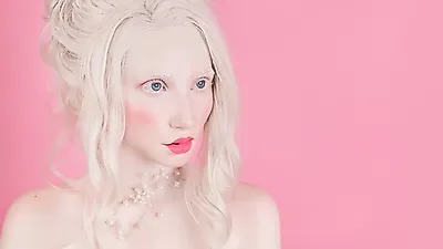 '안녕하세요'에 나온 색소 결핍증, 백색증·알비노증 원인과 증상은?