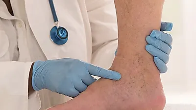 하지정맥류 초기증상, 다리가 무겁고 피곤하다면…하지정맥류 통증 및 치료방법은?
