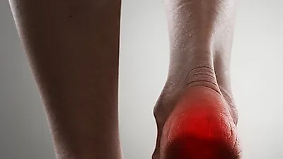 걸을 때마다 통증이 느껴지는 '족저근막염', '족저근막염스트레칭'으로 치료하기