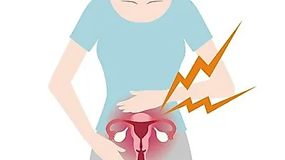 원인에 따라 증상 다른 질염, 증상과 치료는 어떻게? 감기처럼 발병도 잦아