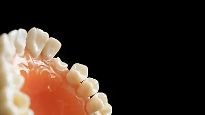 [헬스톡톡]   "부작용도 인지하세요"   임플란트 및 틀니…선택 시 알아야 할 사항은?