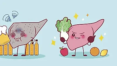 온몸이 피로한  지방간 증상,  최선의 치료는 '예방'…  건강한 식생활로 바꾸자