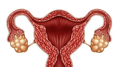 여성들에게 발생하는 자궁경부암 증상과 검사 및 치료 방법