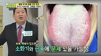 [혀 건강상태] 혀 갈라짐(세로줄)·백태·색깔->혀로 보는 건강! 혀 백태 제거·혓바늘 없애는 법도