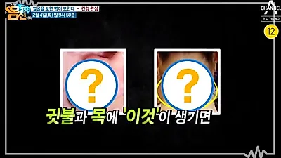 ‘나는 몸신이다’ 치매초기증상 자가진단법 ‘귓불’을 살펴 예방?