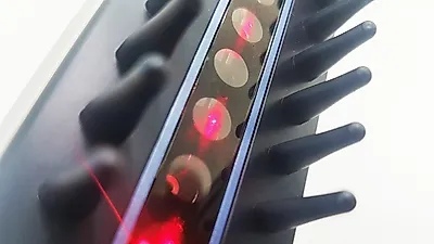레이저 탈모치료기기 '헤어세이버' 탈모증 환자에 희소식 전해