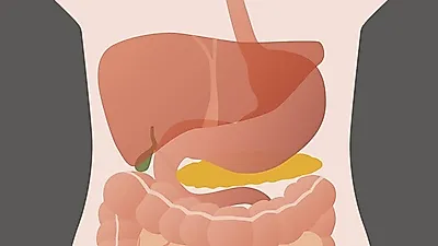 췌장암 증상 악화되면 허리통증까지 이어질 수 있어…췌장암 초기증상 및 치료법은?