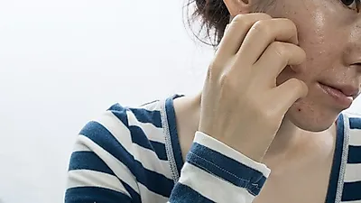 피지·각질 먹고 사는 기생충 '얼굴 모낭충' 제거하려면?