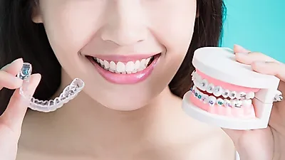 비뚤어진 치아를 위한 '치아교정'의 목적과 '치아교정종류' 및 주의사항