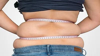 [다이어트 음식]곤약젤리·곤약쌀·곤약면…곤약 효능·부작용, 곤약요리법