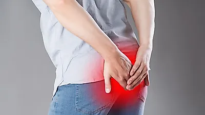 변비로 인해 유발할 수 있는 치질을 알아보자