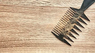 콩과 미역 , 탈모 예방 음식  같이 먹어야 하는 이유는? … 두피열 내리는 법만 알아도  걱정 끝
