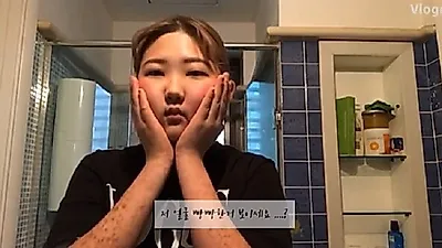 안면비대칭 교정 끝판왕은?, 故최진실 딸 최준희가 고백한 '루프스병·안면비대칭' 원인·증상까지