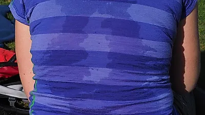손에 땀이 너무 많다면? 다한증의 원인과 증상