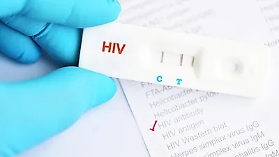 남자·여자 에이즈 초기 증상 붉은 반점? '이병'으로 착각하기 쉬워...감염경로 제대로 알고 대비하자