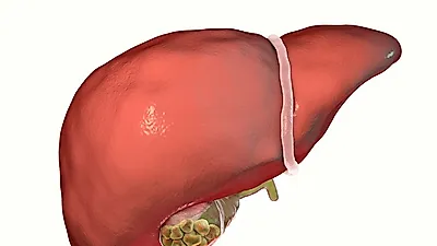 장시간 지속되는 복통 원인, 담석증 증상일 수 있다…담석증수술, 담낭염 증상, 급성담낭염
